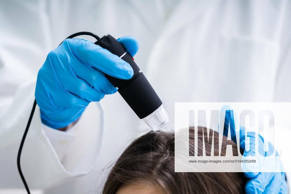 Dermatologist Using Trichoscope For Hair Fall Treatment, Close-up Of Dermatologist Using Trichoscope For Hair Fall Treatment His Clinic model released, Symbolfoto , 06.03.2020 17:36:26,