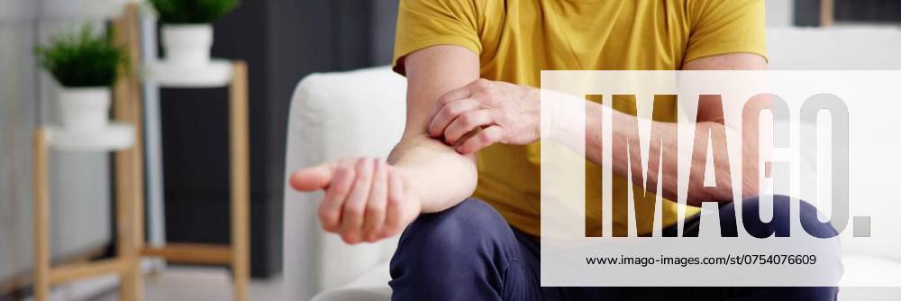 Human man scratching skin due, Human man scratching skin due to itchy psoriasis, Human man scratching skin due to itchy psoriasis model released, Symbolfoto , 13.04.2024,
