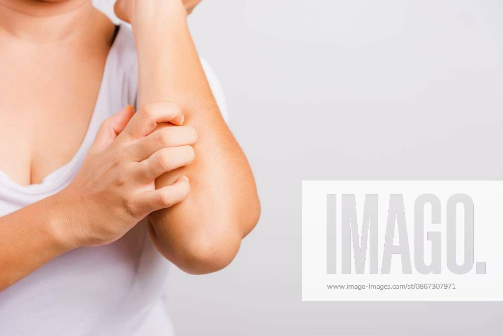 Asian beautiful woman itching her useing hand scratch itch Arm on white background with copy space, Medical and Healthcare concept